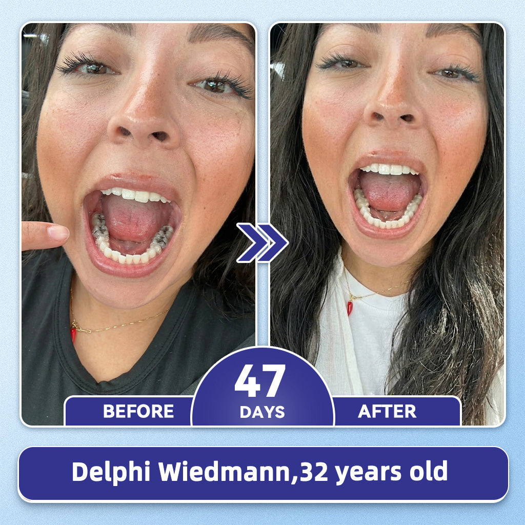 GаrаgеLіnе® 🦷 Tideglusib Fast‑Dissolving Tooth & Gum Repair Oral Strips 🌕(Supports tooth repair and helps relieve gum discomfort and other common oral concerns)