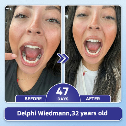 GаrаgеLіnе® 🦷 Tideglusib Fast‑Dissolving Tooth & Gum Repair Oral Strips 🌕(Supports tooth repair and helps relieve gum discomfort and other common oral concerns)