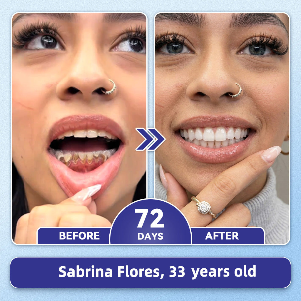 GаrаgеLіnе® 🦷 Tideglusib Fast‑Dissolving Tooth & Gum Repair Oral Strips 🌕(Supports tooth repair and helps relieve gum discomfort and other common oral concerns)