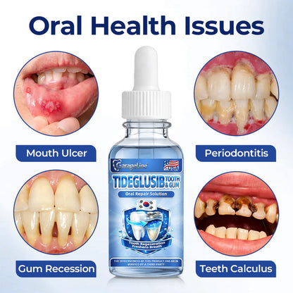 GarageLine® Tideglusib Tooth and Gum Repair Solution🔥🔥( Rebuild Enamel & Dentin Strengthen Gums. Eradicate Tartar & Odor Stop Tooth Sensitivity)