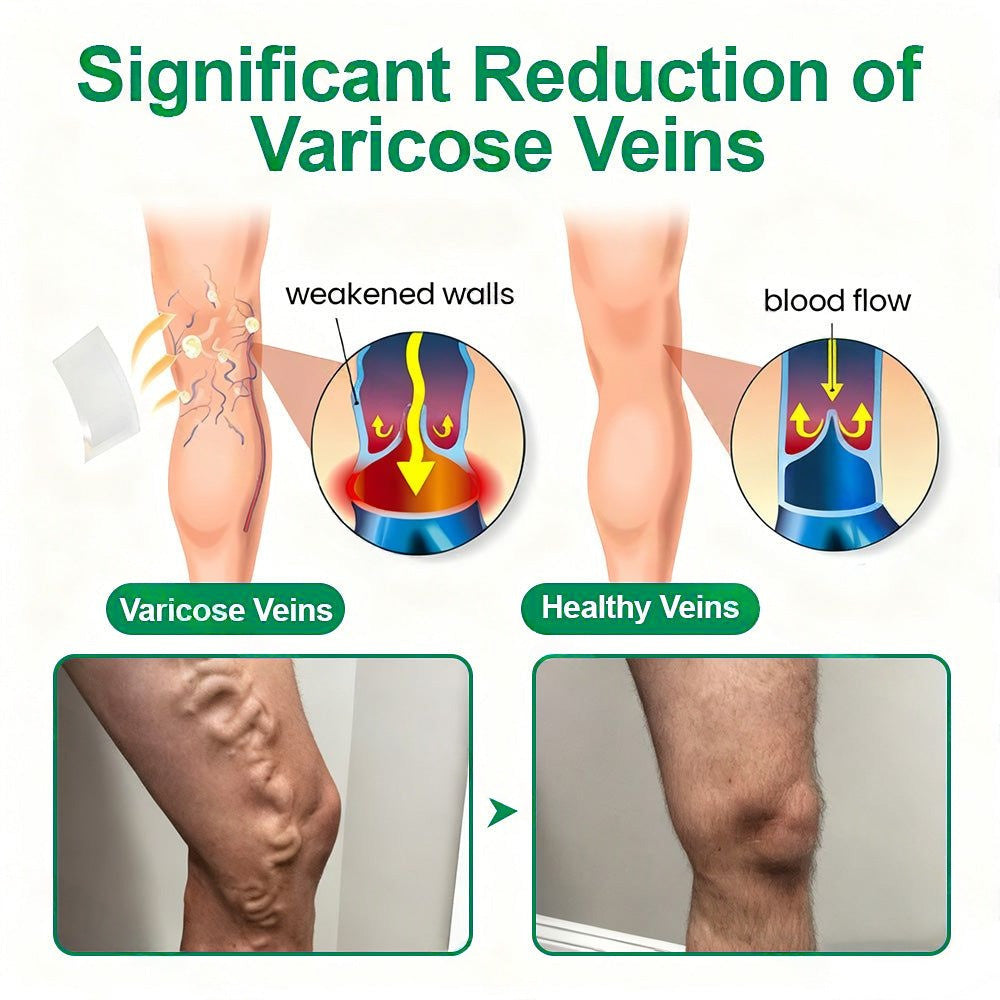 Healrize® VeinTarget Microneedle Patch💙Instant Relief, Long-Term Results