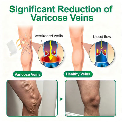 Healrize® VeinTarget Microneedle Patch💙Instant Relief, Long-Term Results